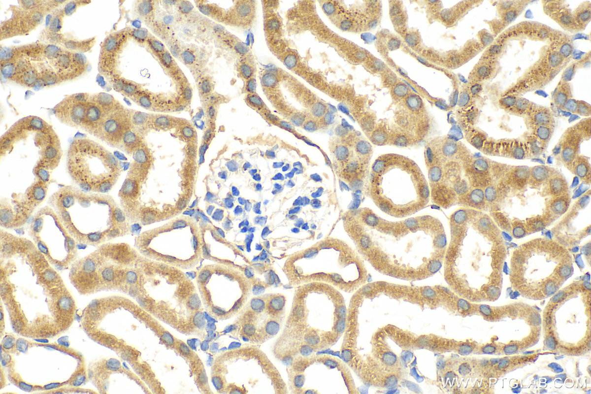 IHC staining of mouse kidney using 23247-1-AP