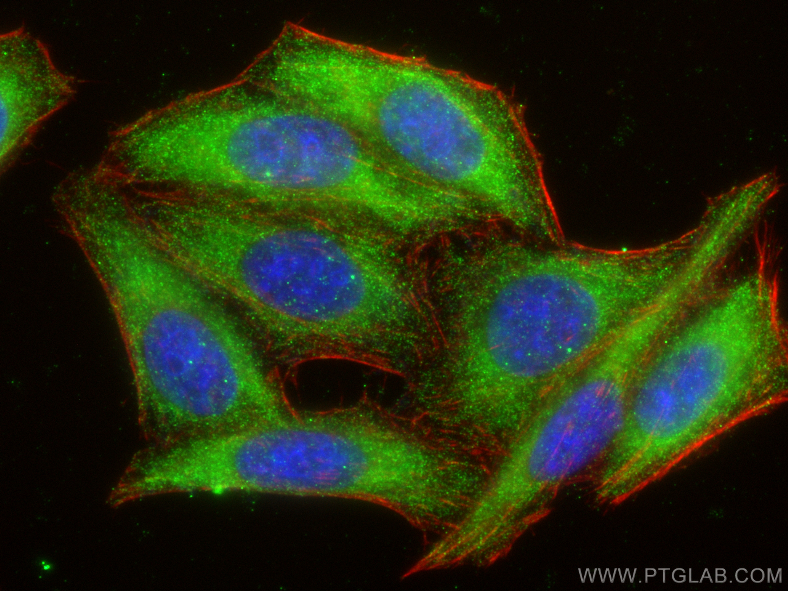 IF Staining of HepG2 using 12604-1-AP