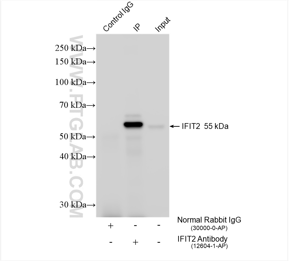 IP experiment of A431 using 12604-1-AP