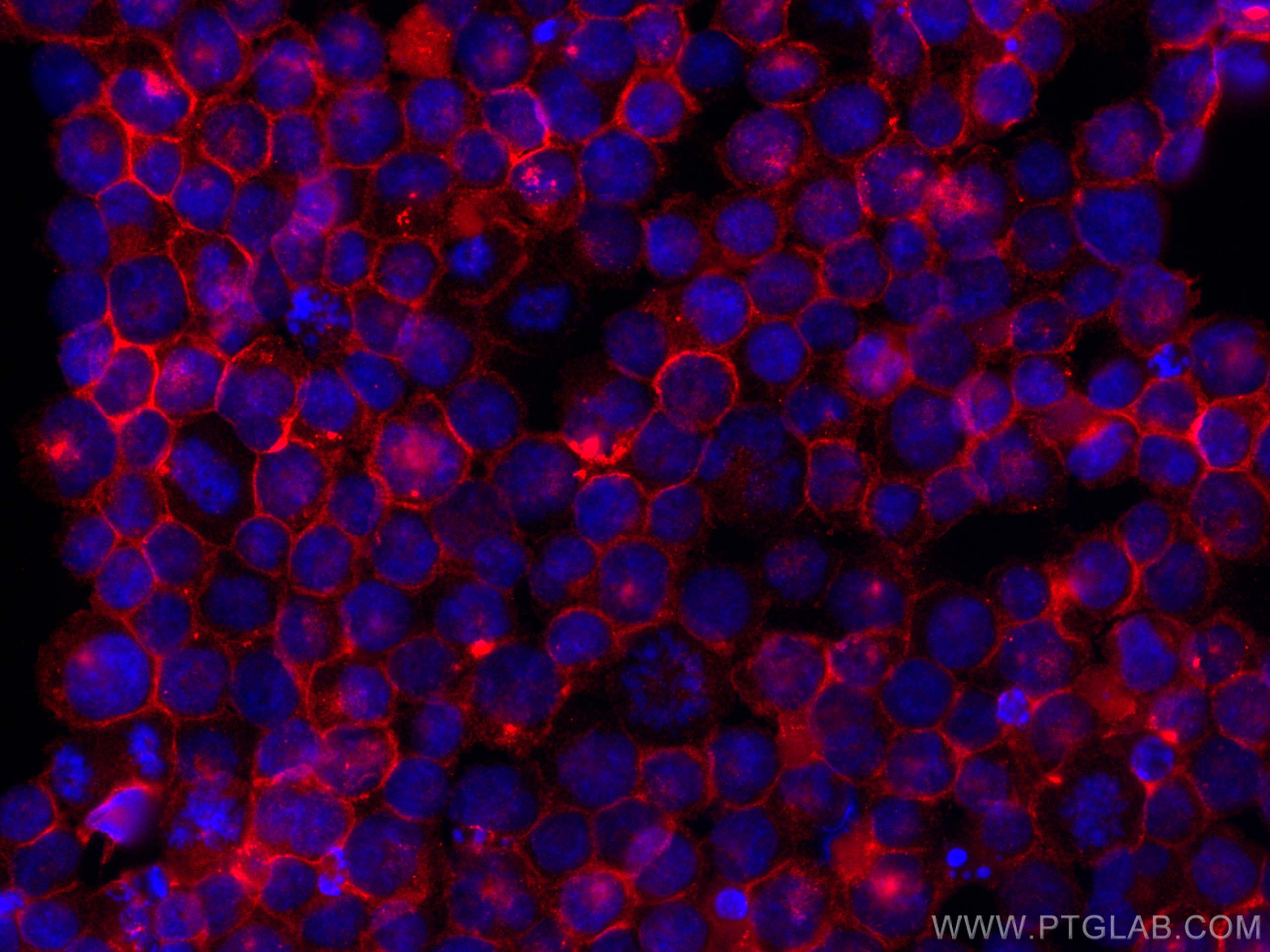 IF Staining of K-562 using CL594-60074