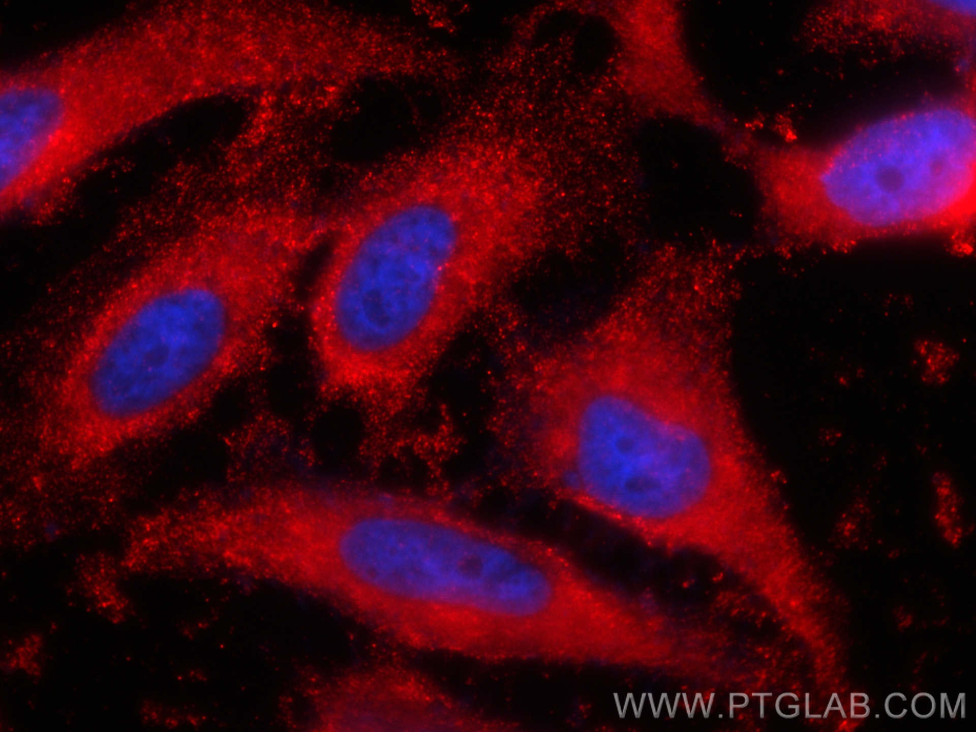 IF Staining of HeLa using CL594-66081