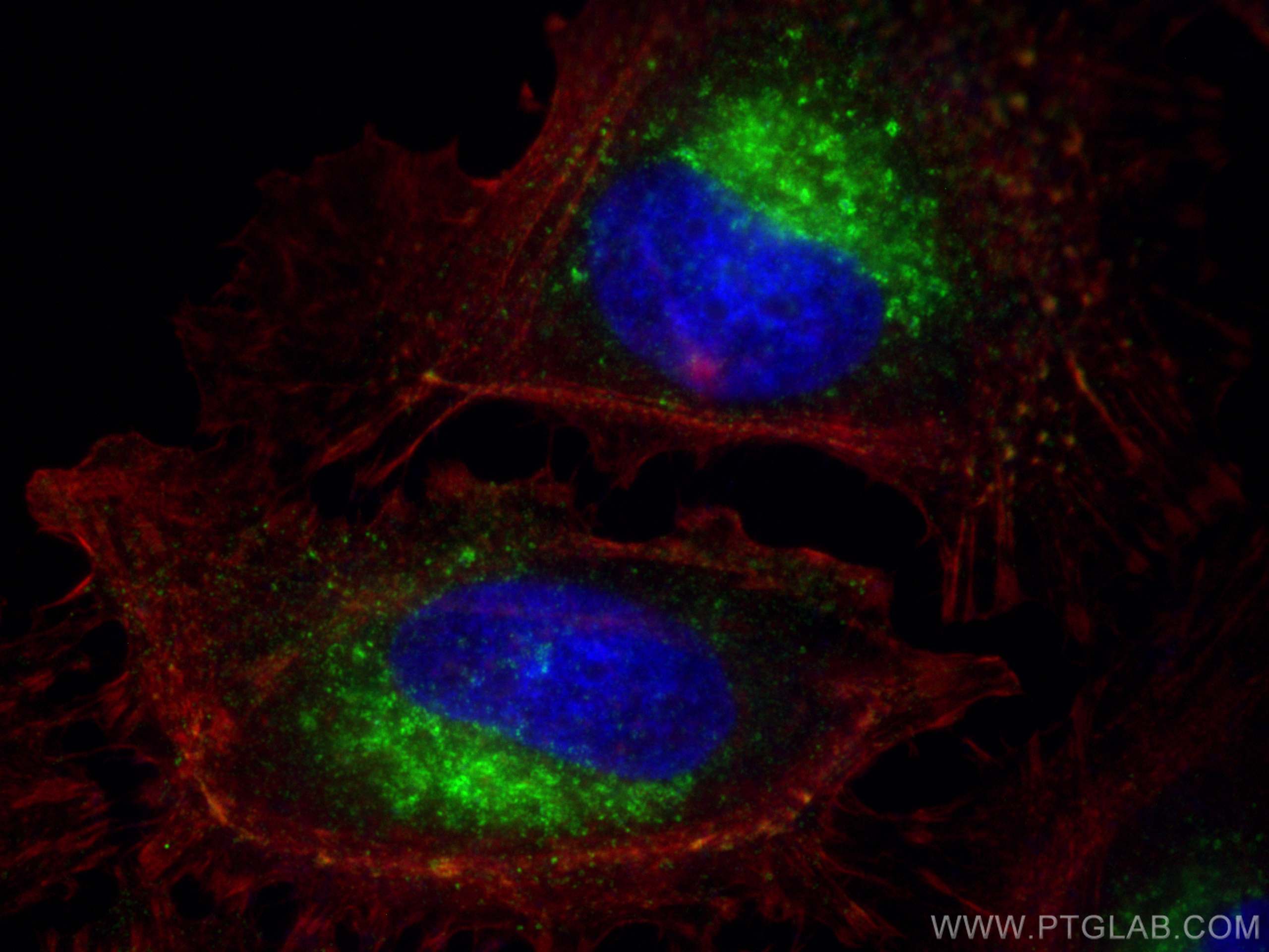 IF Staining of HeLa using 12769-1-AP