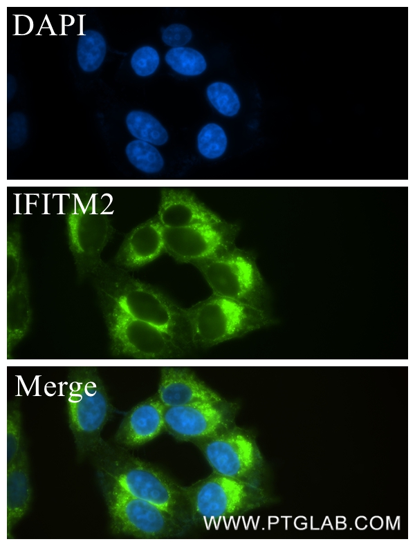 IF Staining of HepG2 using 83455-5-RR