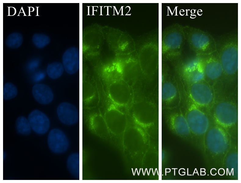 IF Staining of HepG2 using 83455-5-RR