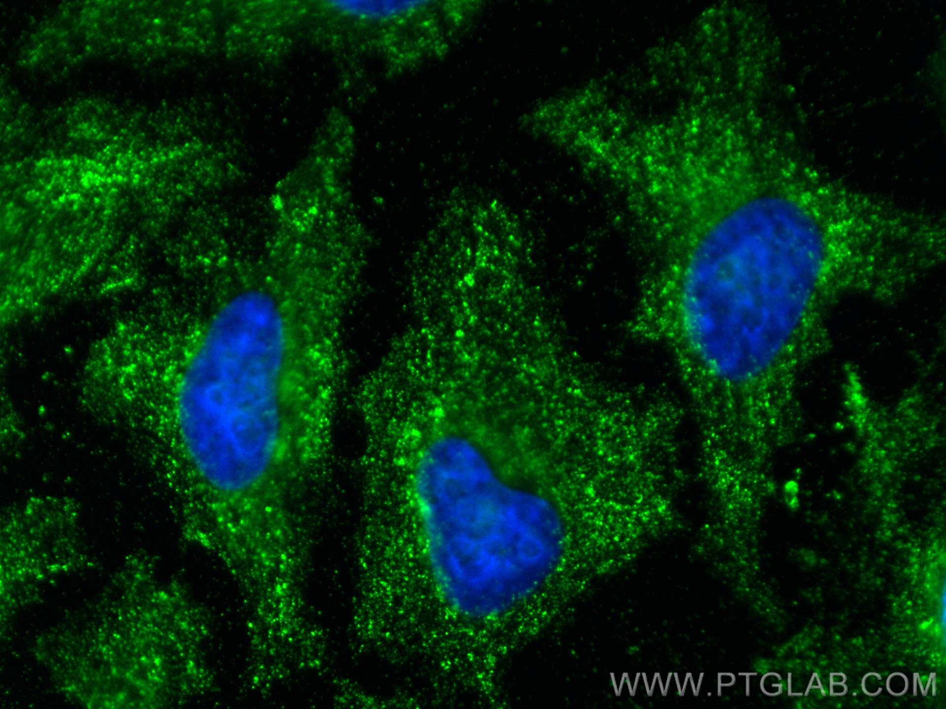 IF Staining of HeLa using 66081-1-Ig