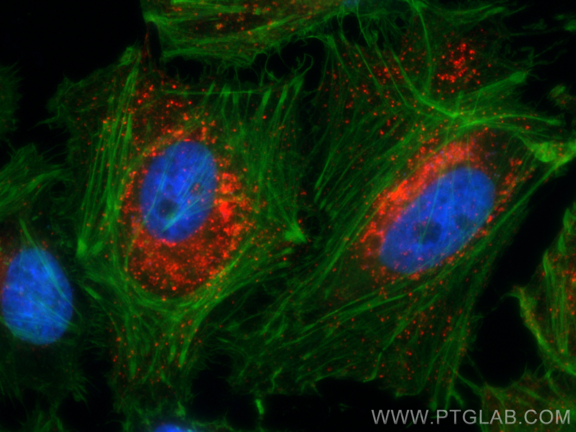 IF Staining of HeLa using CL594-11714