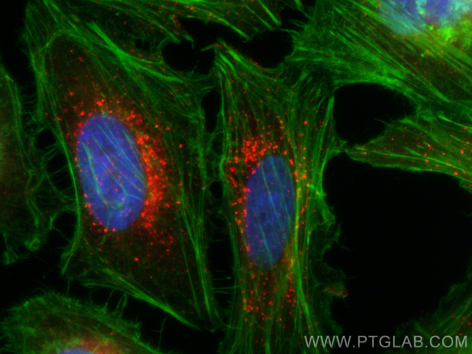 IF Staining of HeLa using CL594-11714