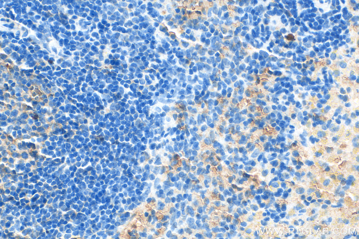 IHC staining of rat spleen using 30293-1-AP