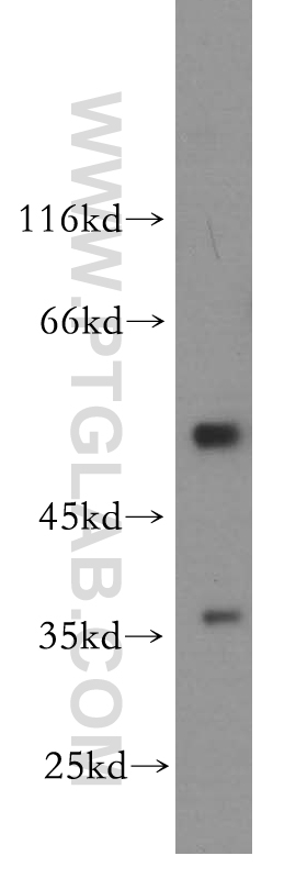 WB analysis of HeLa using 12939-1-AP