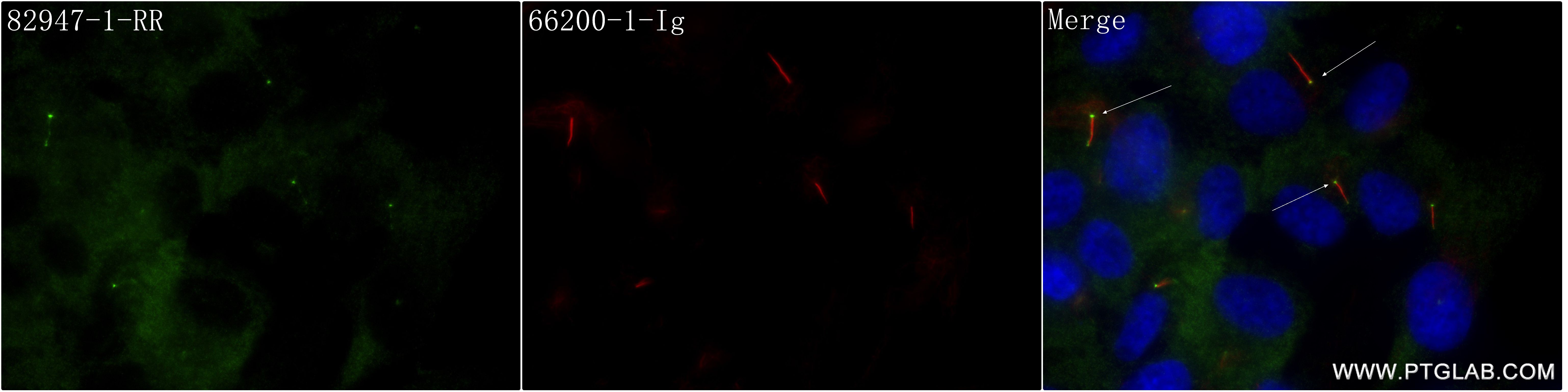 IF Staining of hTERT-RPE1 using 82947-1-RR