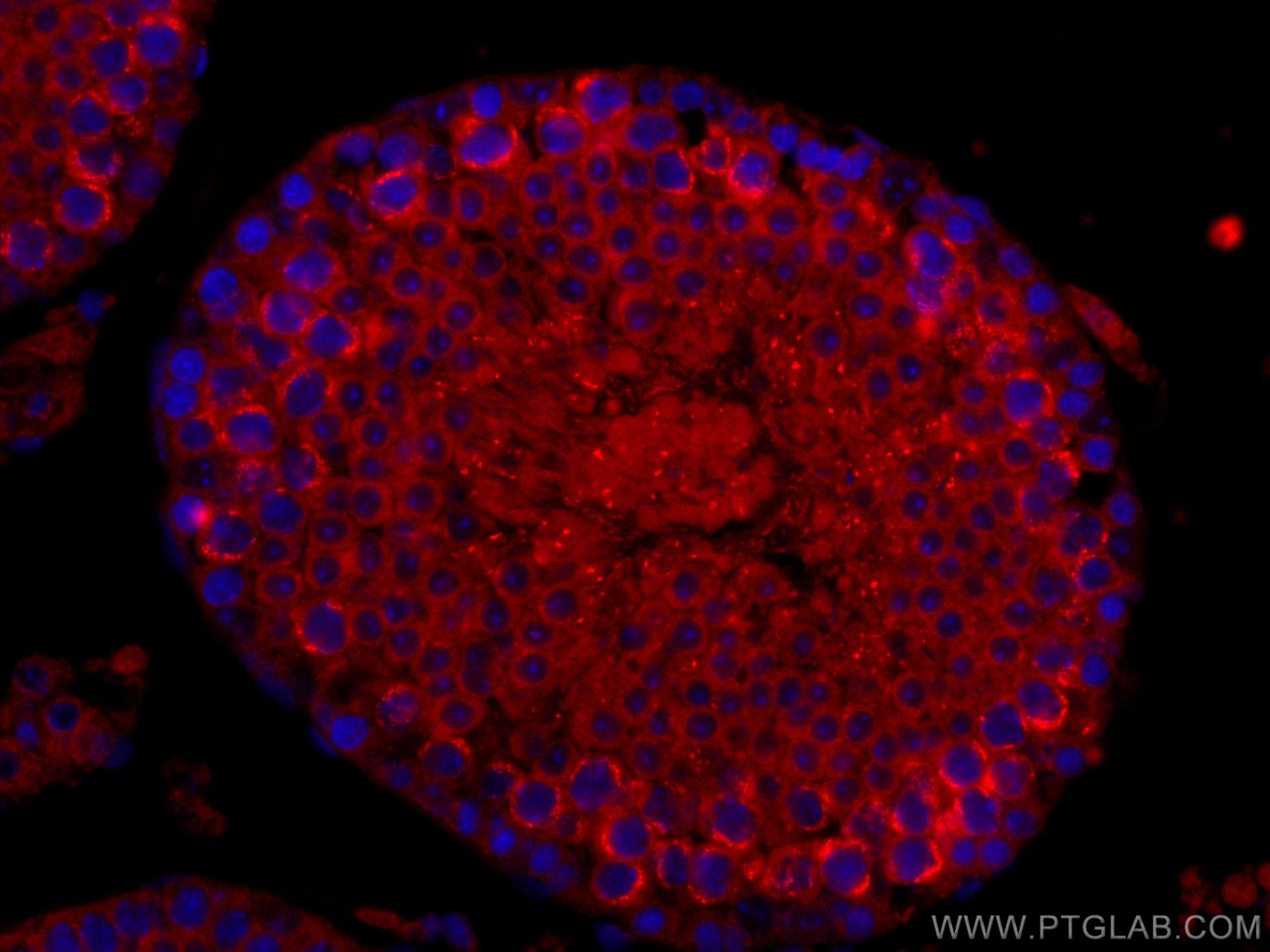 IF Staining of mouse testis using CL594-17460