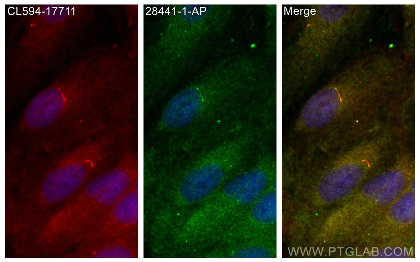 IF Staining of ARPE-19 using 28441-1-AP