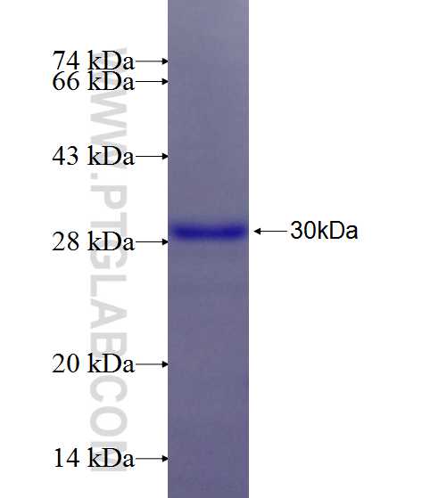 IFT74 fusion protein Ag26348 SDS-PAGE