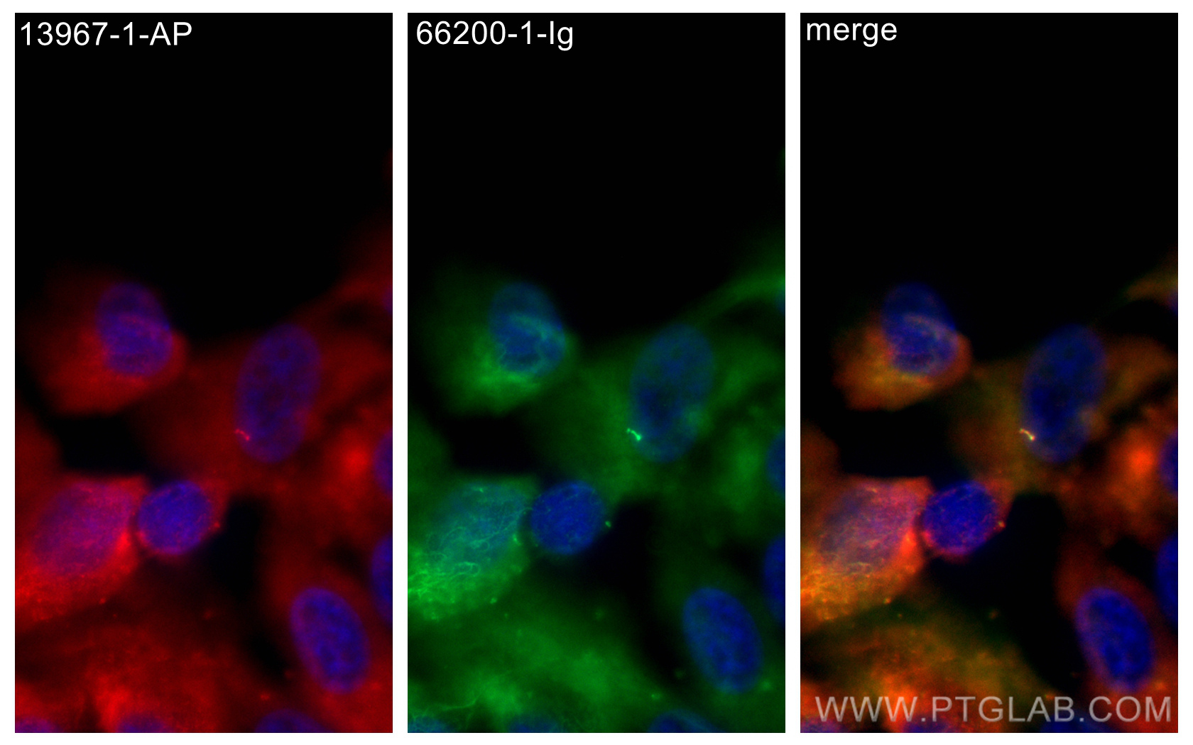 IF Staining of hTERT-RPE1 using 13967-1-AP