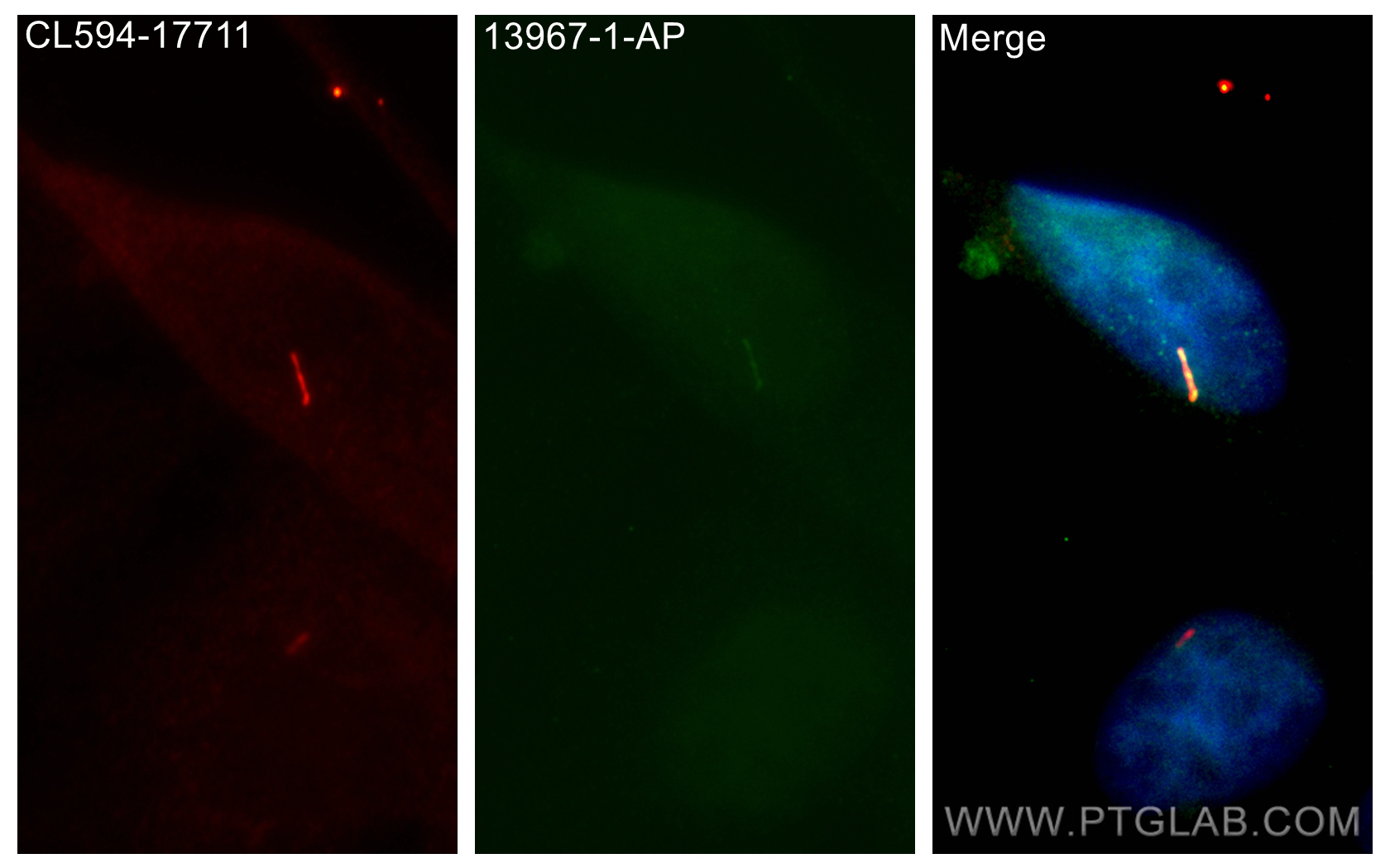 IF Staining of MDCK using 13967-1-AP