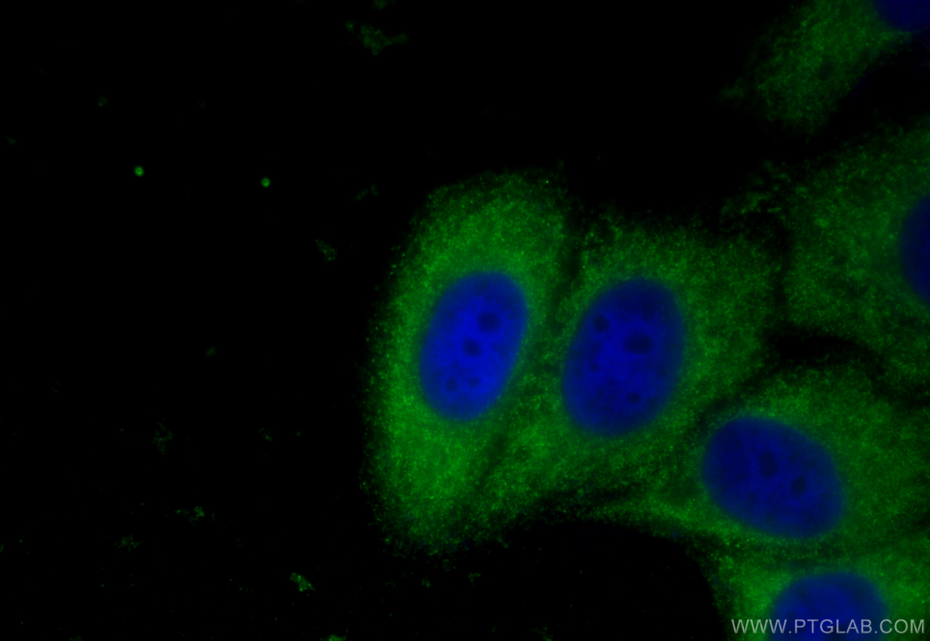 IF Staining of HepG2 using 20253-1-AP