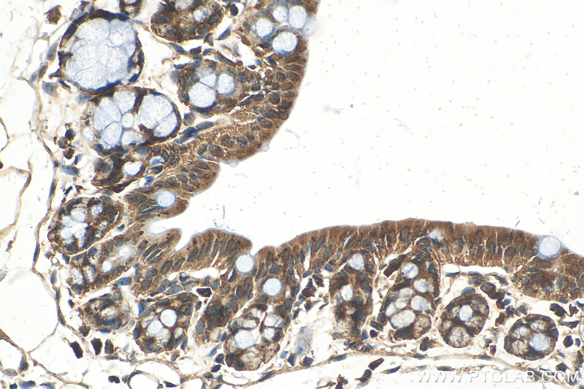 IHC staining of mouse colon using 20253-1-AP