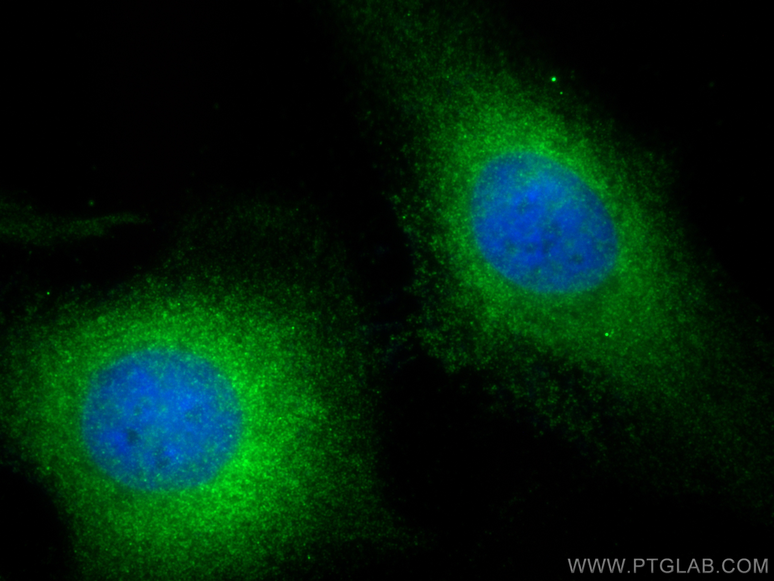 IF Staining of HeLa using 10189-2-AP