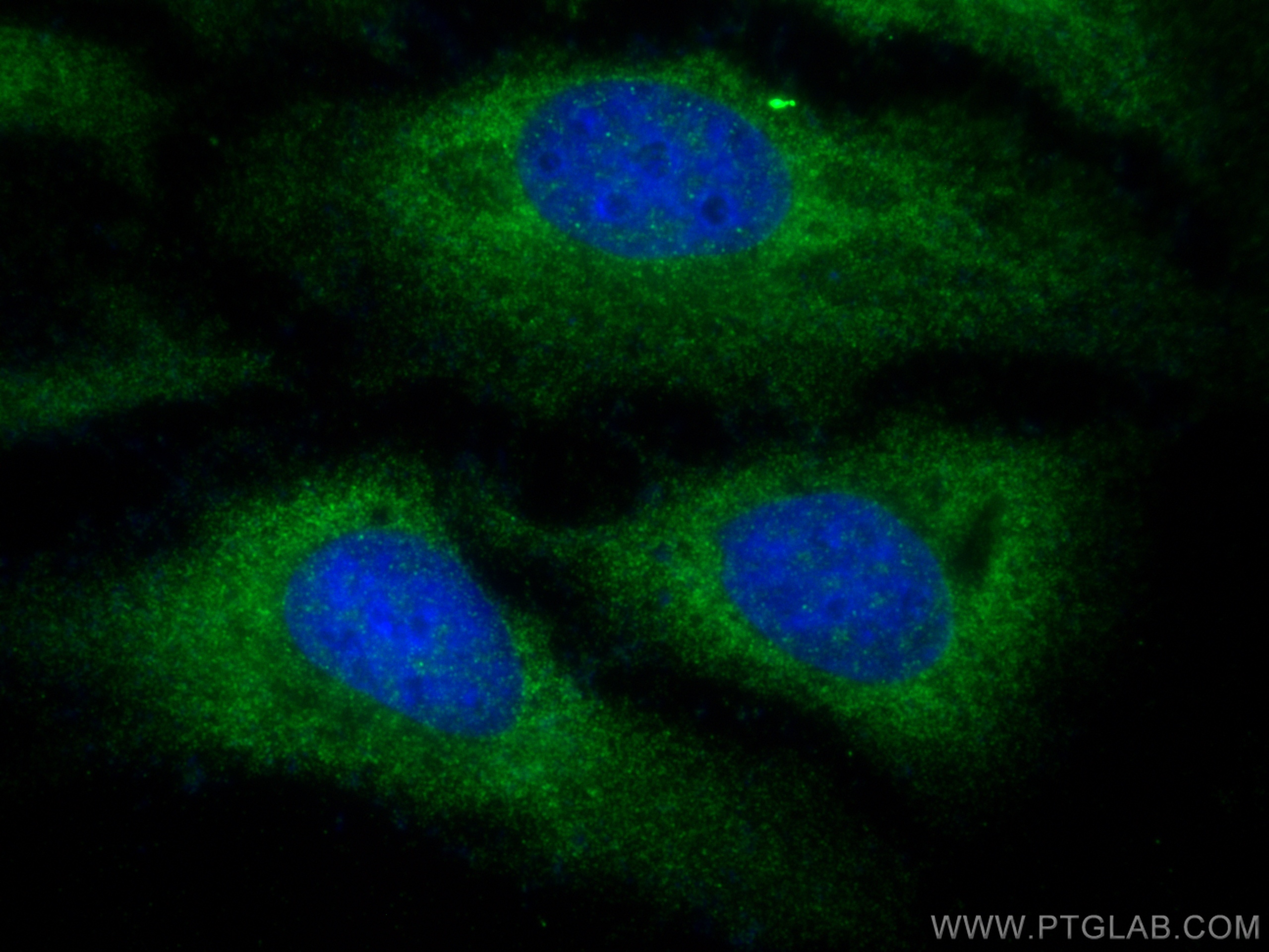 IF Staining of HeLa using 10189-2-AP