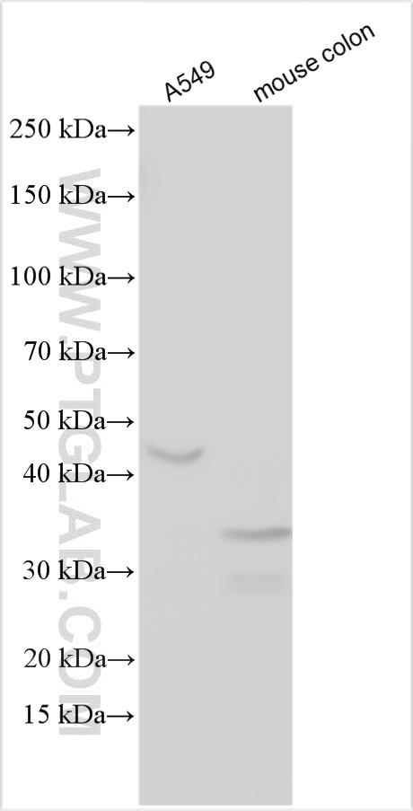 WB analysis using 30593-1-AP