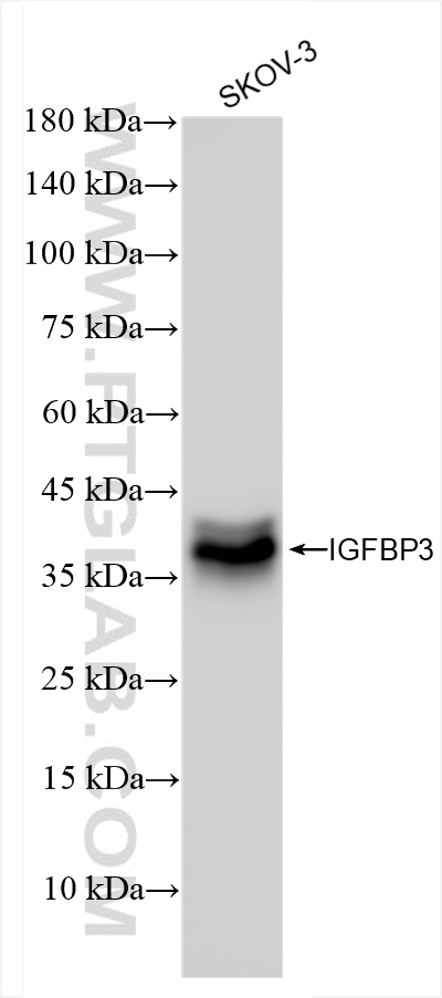 WB analysis of SKOV-3 using 84470-4-RR (same clone as 84470-4-PBS)