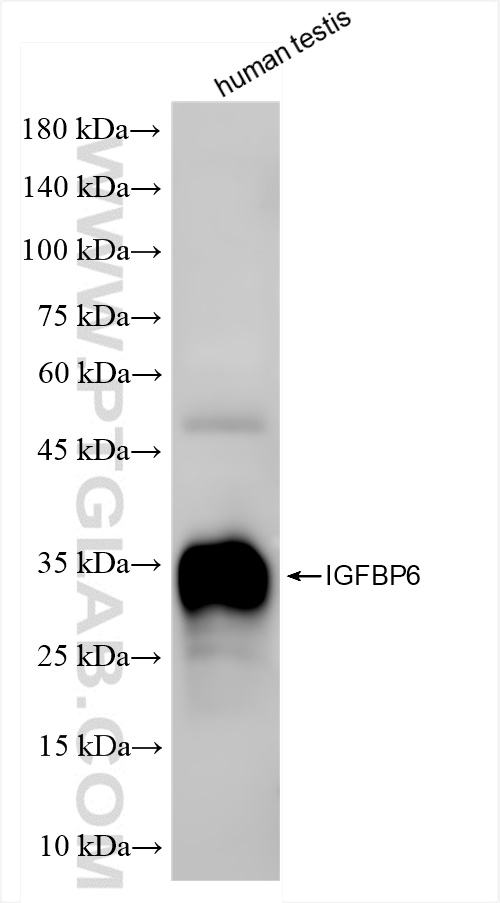 WB analysis of human testis using 84364-5-RR