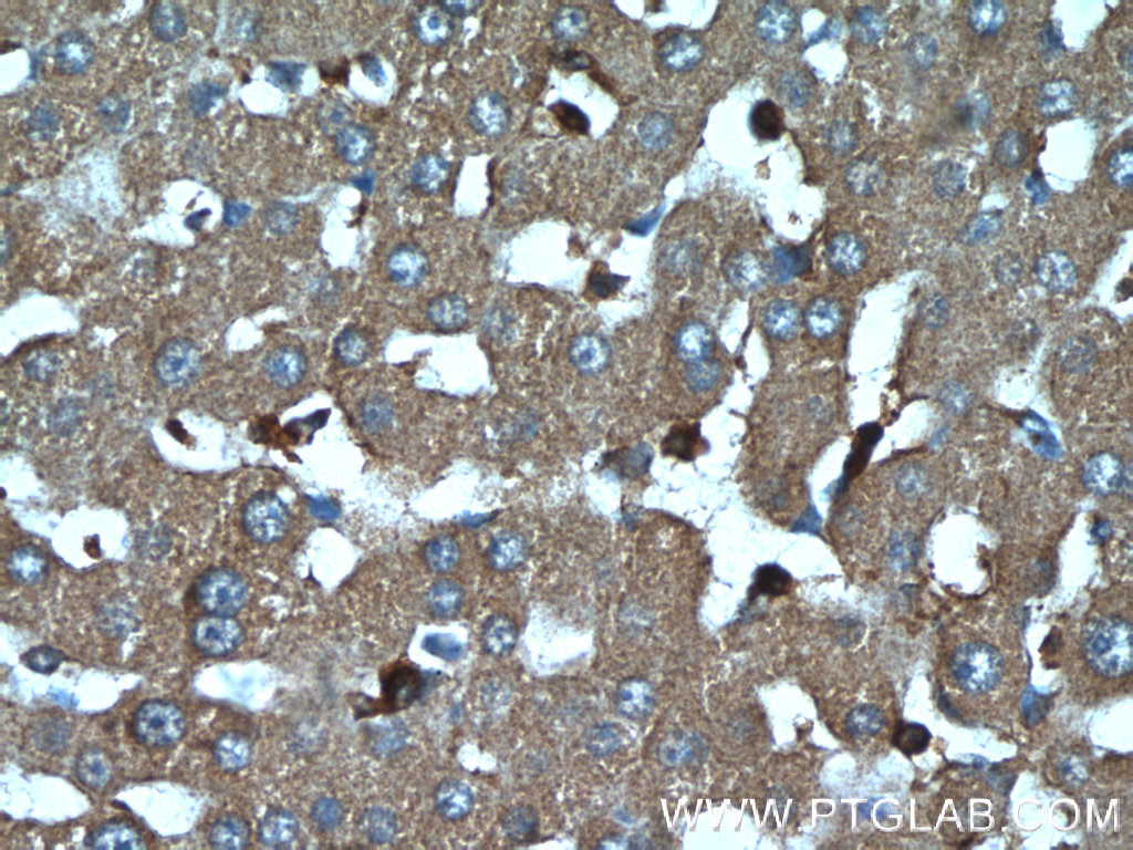 IHC staining of human liver using 19961-1-AP