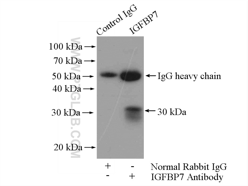 IP experiment of mouse appendix using 19961-1-AP