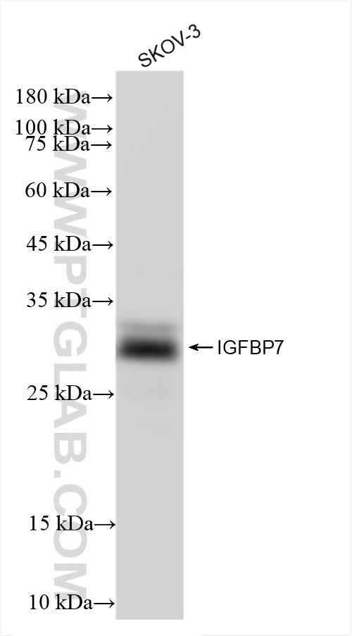 WB analysis of SKOV-3 using 83292-5-RR