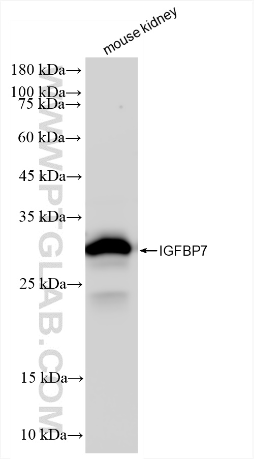 WB analysis of mouse kidney using 83292-5-RR