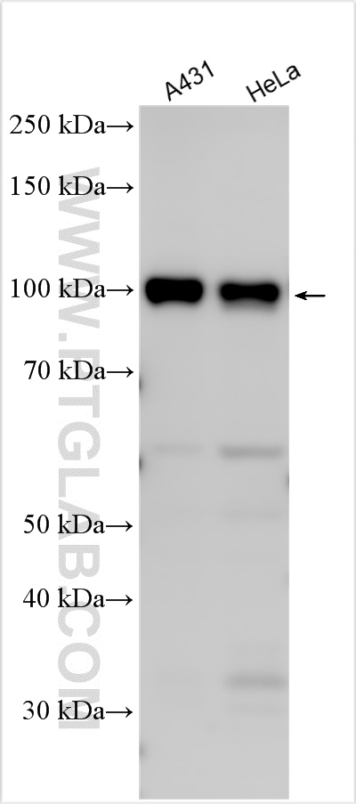 WB analysis using 25095-1-AP