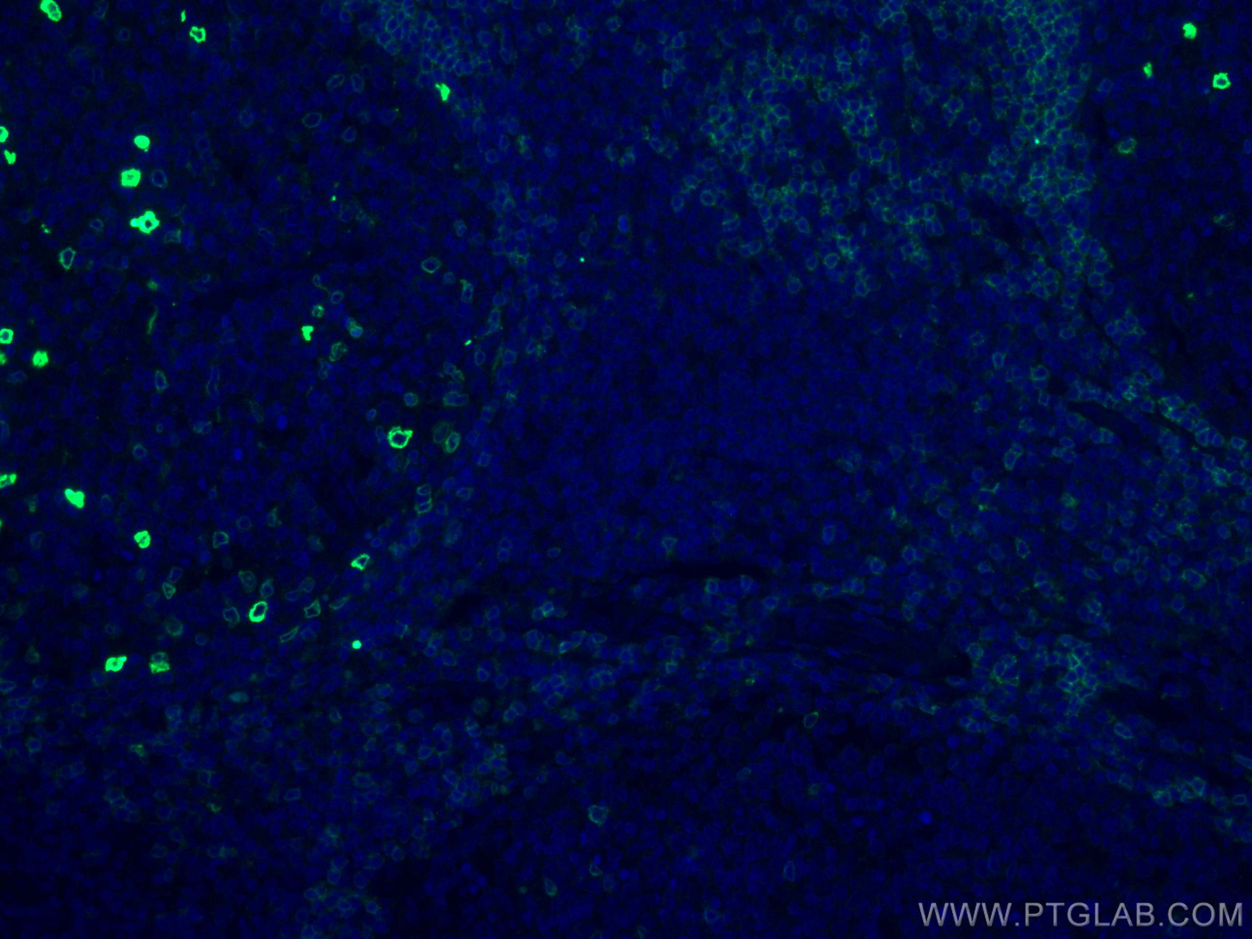 IF Staining of human tonsillitis using 67538-1-Ig (same clone as 67538-1-PBS)