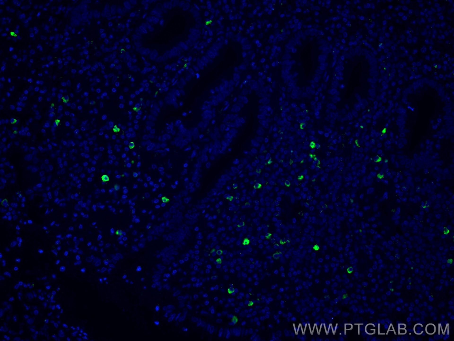 IF Staining of human appendicitis using CL488-66484