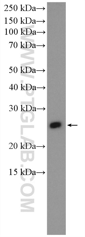 IGLV6-57