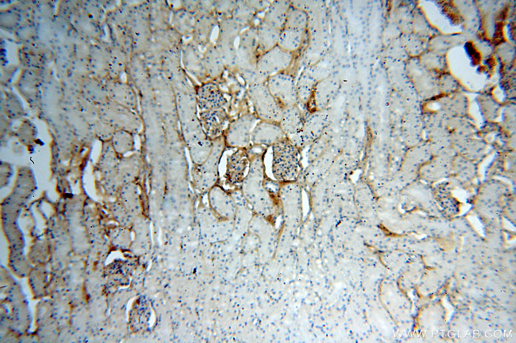 IHC staining of human kidney using 14003-1-AP