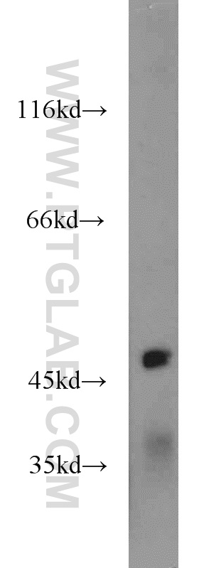 WB analysis of mouse brain using 21465-1-AP