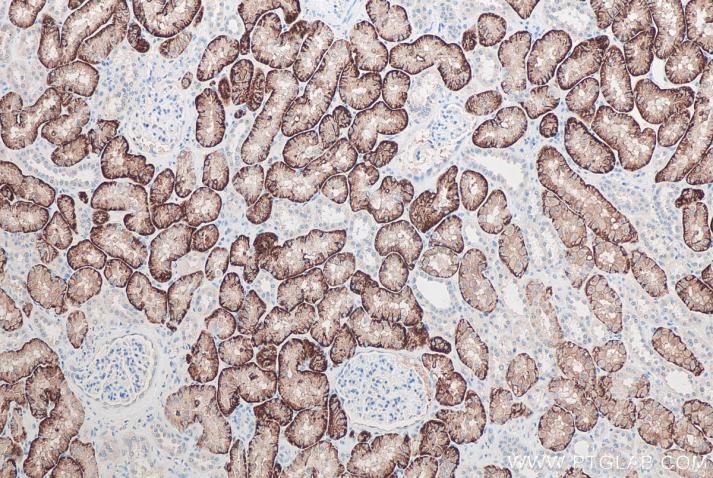 使用 Proteintech 的 SLC13A3 兔多克隆抗体 (26184-1-AP) 和兔/小鼠一抗自主全应用免疫组化试剂盒(PK10019) 对人肾脏组织进行免疫组织化学分析。