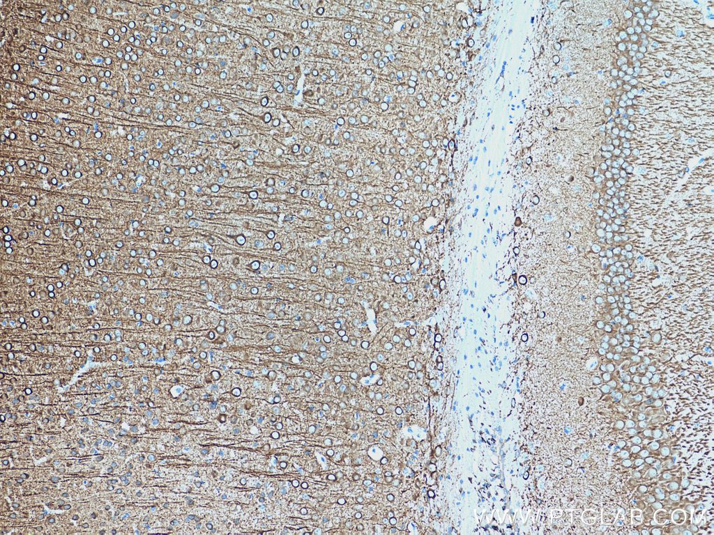 Immunohistochemical analysis of paraffin-embedded mouse brain tissue slide using 17490-1-AP (MAP2 antibody) at dilution of 1:5000 (under 10x lens). Heat mediated antigen retrieval with Tris-EDTA buffer (pH 9.0).