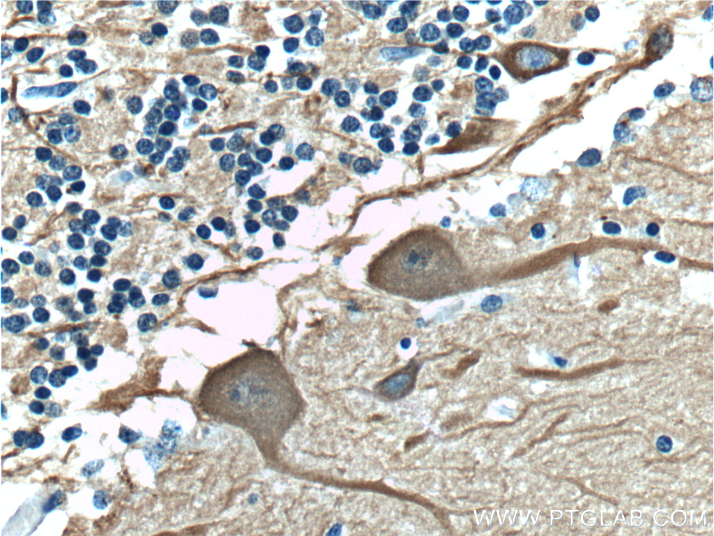 Immunohistochemical analysis of paraffin-embedded human cerebellum tissue slide using 66375-1-Ig (TUBB3-specific Antibody) at dilution of 1:400 (under 40x lens).