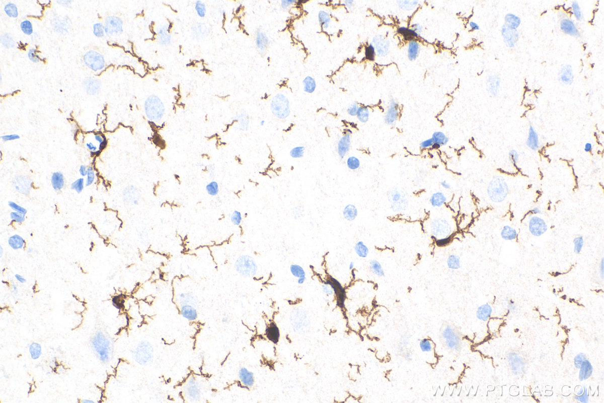 Immunohistochemical analysis of paraffin-embedded rat brain tissue slide using 81728-1-RR (IBA1 antibody) at dilution of 1:1000 (under 40x lens). Heat mediated antigen retrieval with Tris-EDTA buffer (pH 9.0).