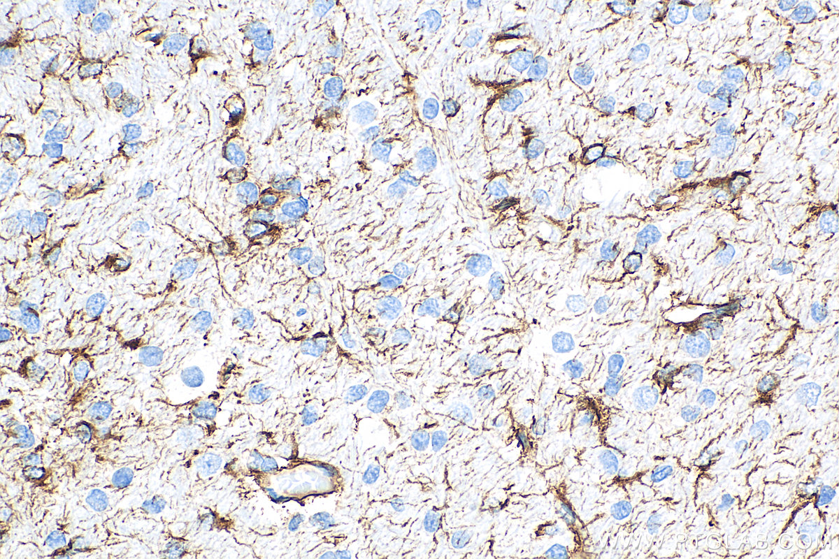 Immunohistochemical analysis of paraffin-embedded rat brain tissue slide using 81063-1-RR (GFAP antibody) at dilution of 1:9900 (under 40x lens). Heat mediated antigen retrieval with Tris-EDTA buffer (pH 9.0).