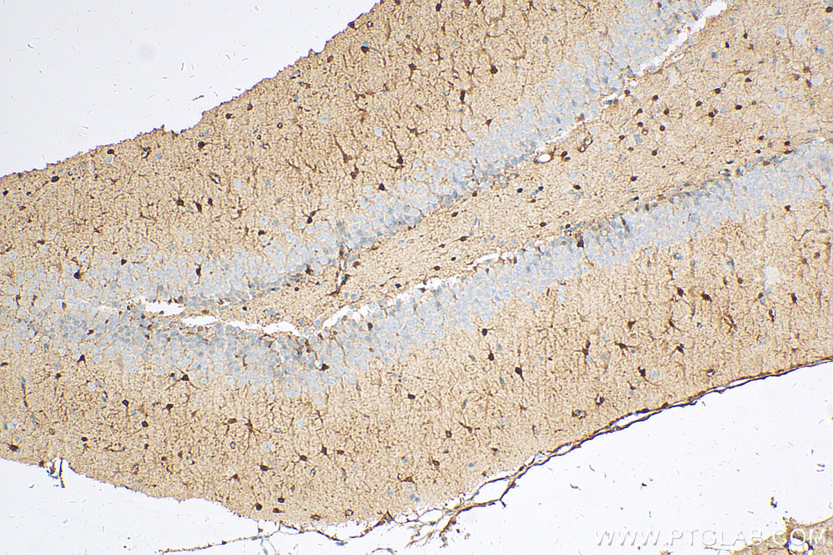 Immunohistochemical analysis of paraffin-embedded rat brain tissue slide using 66616-1-Ig (S100 Beta antibody) at dilution of 1:1000 (under 10x lens). Heat mediated antigen retrieval with Tris-EDTA buffer (pH 9.0).