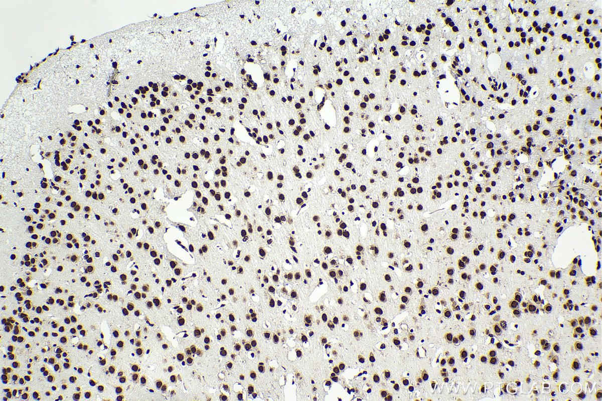 Immunohistochemical analysis of paraffin-embedded mouse brain tissue slide using 80001-1-RR (TDP-43 antibody) at dilution of 1:5000 (under 10x lens). Heat mediated antigen retrieval with Tris-EDTA buffer (pH 9.0). Multi-rAb Polymer HRP-Goat Anti-Rabbit/Mouse Universal Recombinant secondary antibody RGAU011 was used for detection.