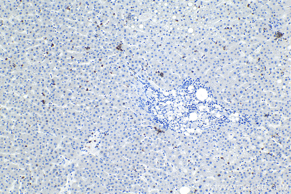 Immunohistochemical analysis of paraffin-embedded human liver tissue slide using 66177-1-Ig (MPO antibody) at dilution of 1:5000 (under 10x lens). Heat mediated antigen retrieval with Tris-EDTA buffer (pH 9.0). Multi-rAb Polymer HRP-Goat Anti-Rabbit/Mouse Universal Recombinant secondary antibody RGAU011 was used for detection.