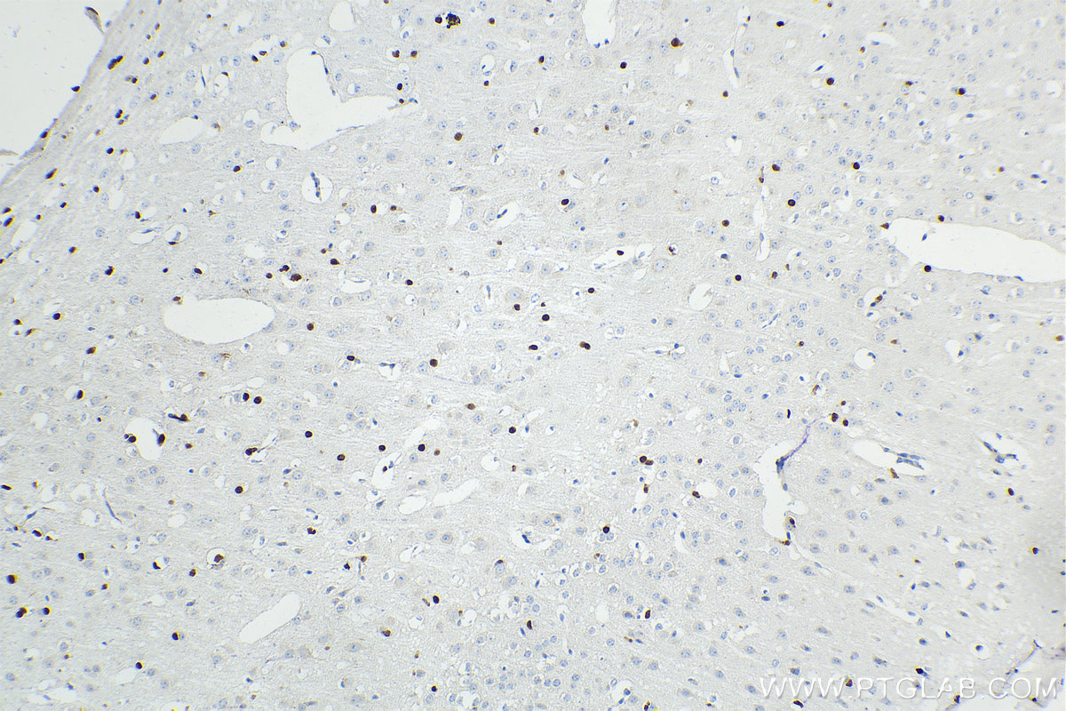 Immunohistochemical analysis of paraffin-embedded mouse brain tissue slide using 66786-1-Ig (SOX10 antibody) at dilution of 1:10000 (under 10x lens). Heat mediated antigen retrieval with Tris-EDTA buffer (pH 9.0). Multi-rAb Polymer HRP-Goat Anti-Rabbit/Mouse Universal Recombinant secondary antibody RGAU011 was used for detection.