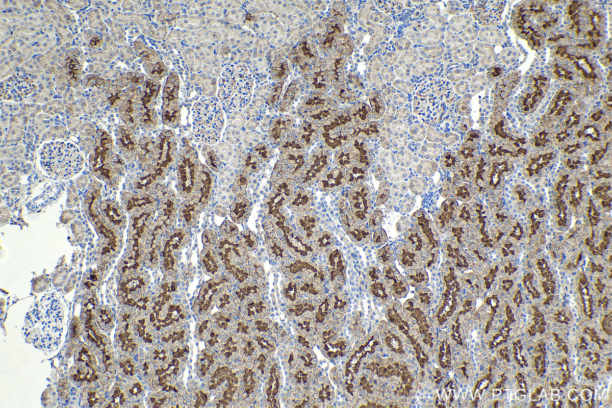 Immunohistochemical analysis of paraffin-embedded rat kidney tissue slide using 67479-1-Ig (SLC22A7 antibody) at dilution of 1:4000 (under 10x lens). Heat mediated antigen retrieval with Tris-EDTA buffer (pH 9.0). Multi-rAb Polymer HRP-Goat Anti-Rabbit/Mouse Universal Recombinant secondary antibody RGAU011 was used for detection.