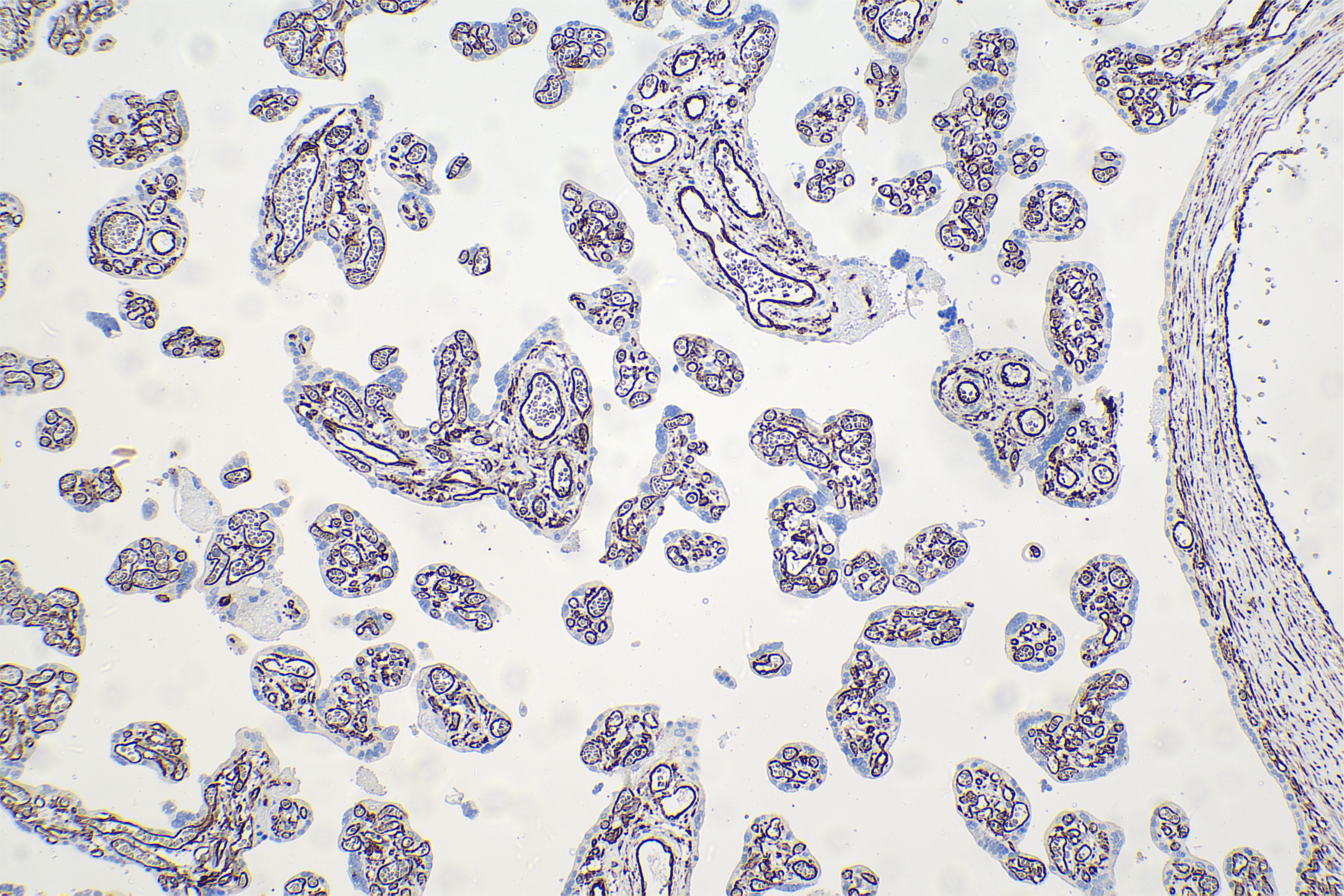 Immunohistochemical analysis of paraffin-embedded human placenta tissue slide using 80232-1-RR (Vimentin rabbit recombinant antibody) at dilution of 1:2500 (under 10x lens). Heat mediated antigen retrieval with Tris-EDTA buffer (pH 9.0). Multi-rAb Polymer HRP-Goat anti-Rabbit/Mouse Universal Recombinant Secondary Antibody RGAU011 was used for detection. The staining was performed on Celnovte's CNT360-M1 autostainer.