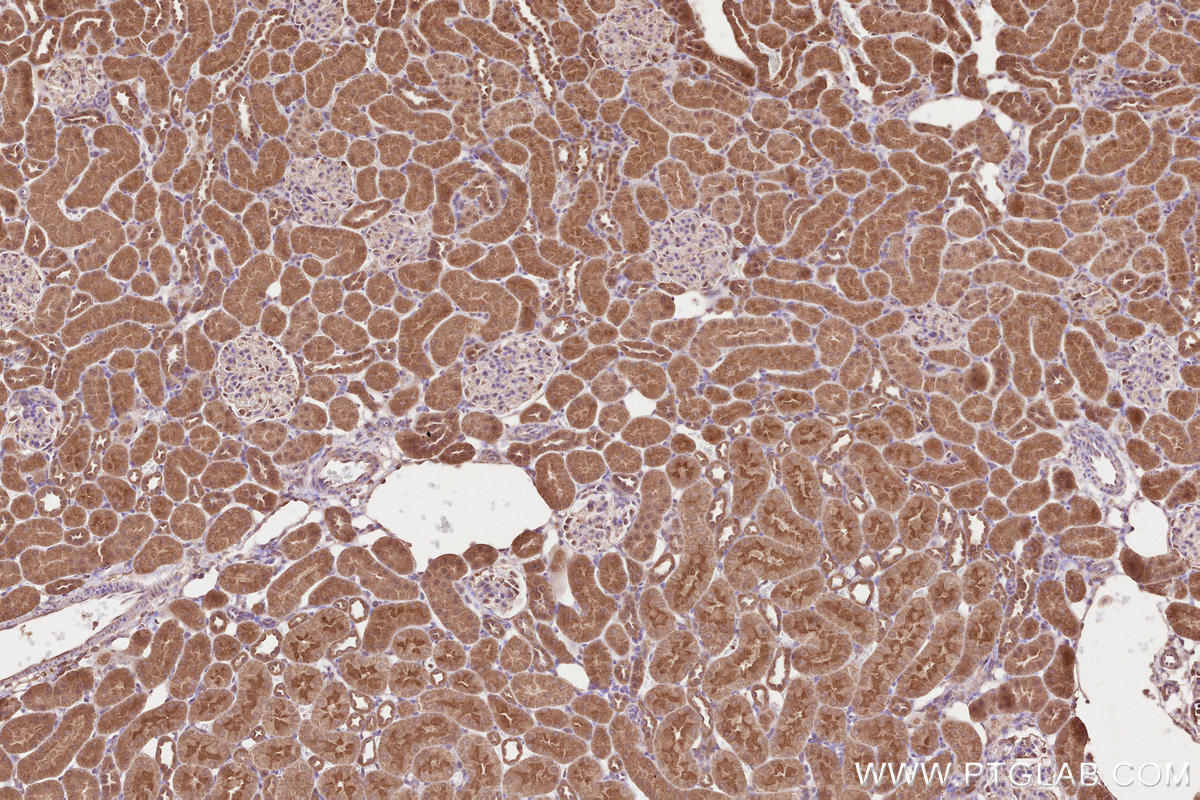 Immunohistochemical analysis of paraffin-embedded rat kidney tissue slide using KHC2588 (AAGAB IHC Kit).