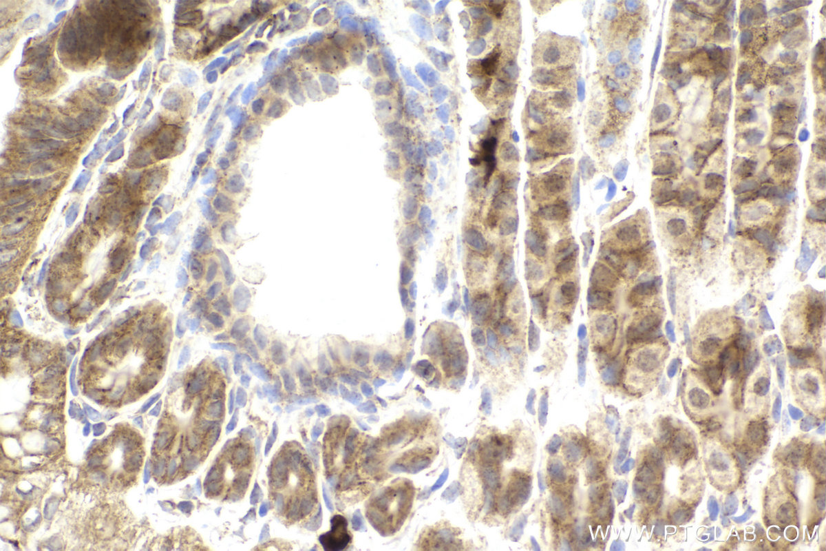 Immunohistochemical analysis of paraffin-embedded mouse stomach tissue slide using KHC2240 (ABCD1 IHC Kit).