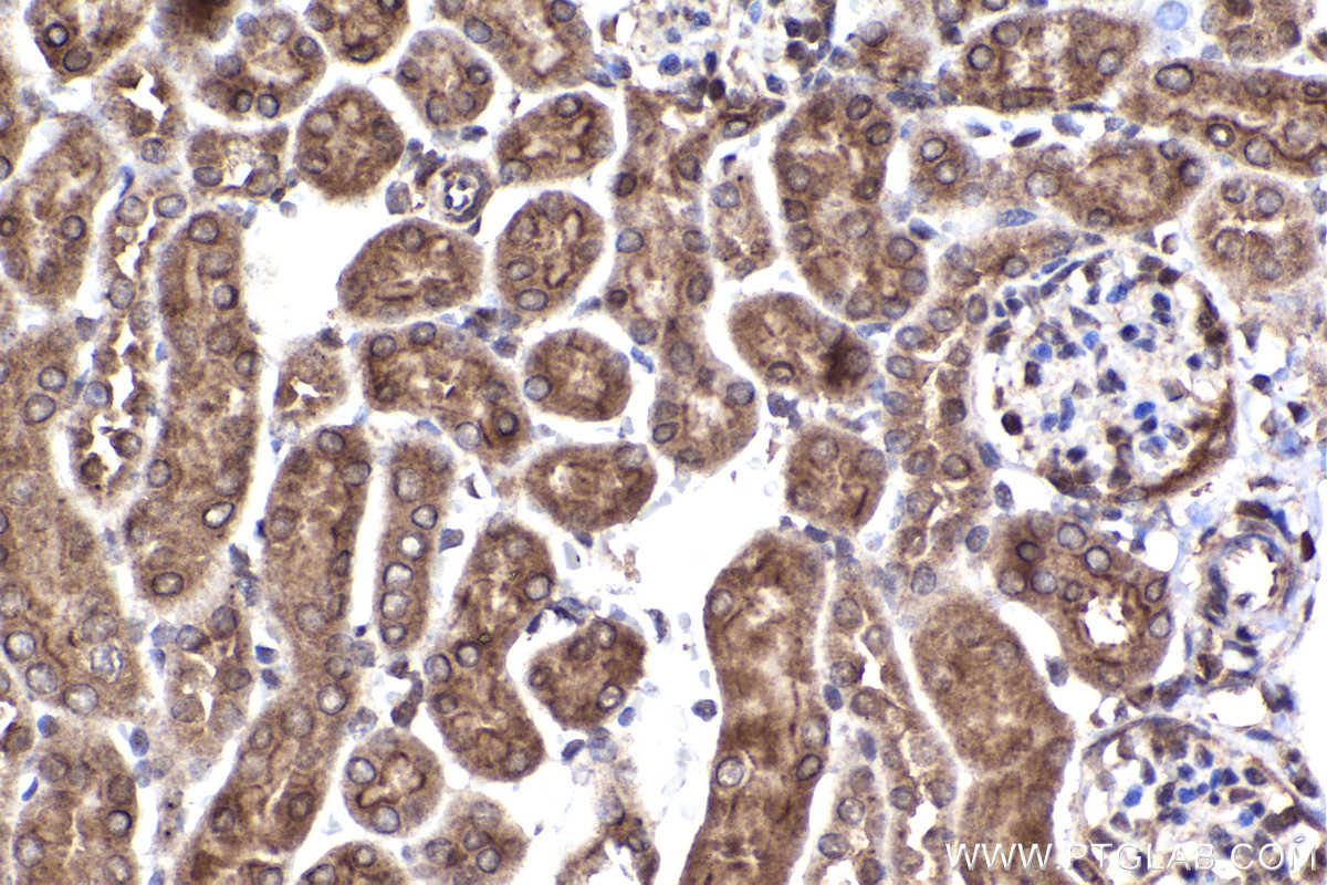 Immunohistochemical analysis of paraffin-embedded mouse kidney tissue slide using KHC2240 (ABCD1 IHC Kit).